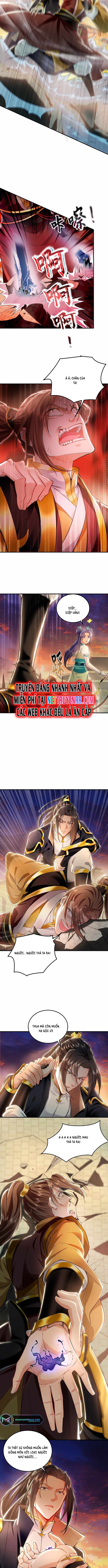Ta Có Trăm Vạn Tốc Độ Đánh: Chapter 20