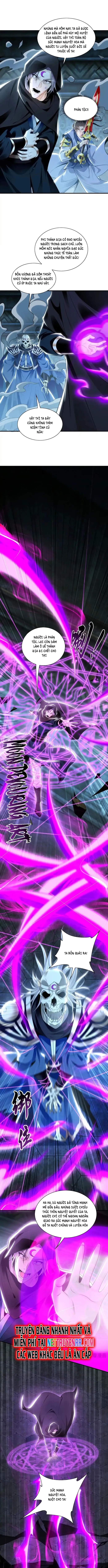 Ta Có Trăm Vạn Tốc Độ Đánh: Chapter 94