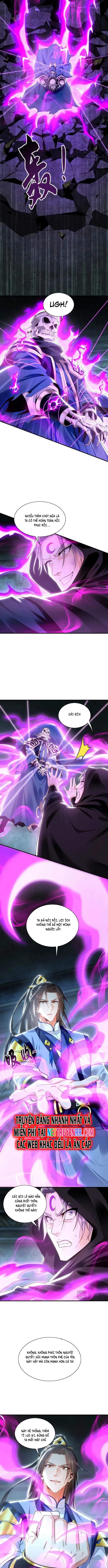 Ta Có Trăm Vạn Tốc Độ Đánh: Chapter 94