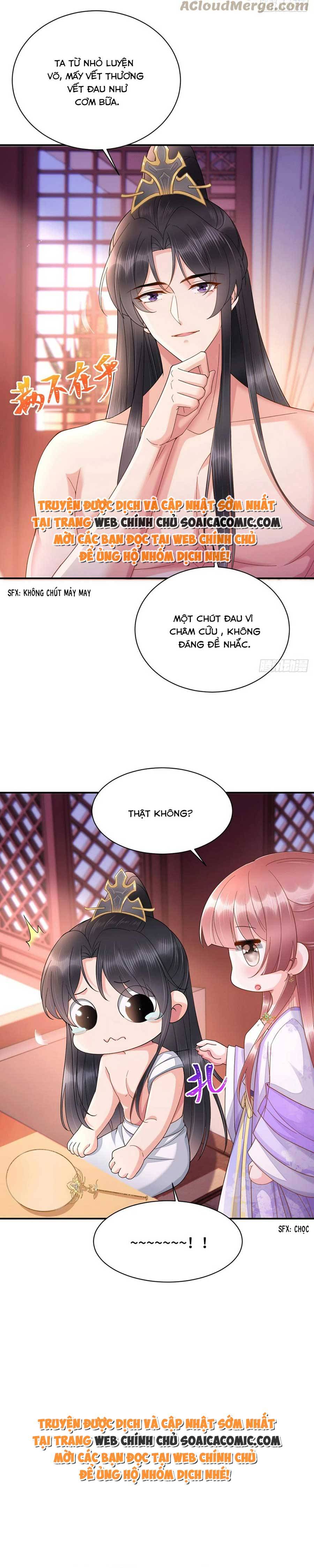 Thần Y Vương Phi Có Miệng Quạ Đen: Chapter 26